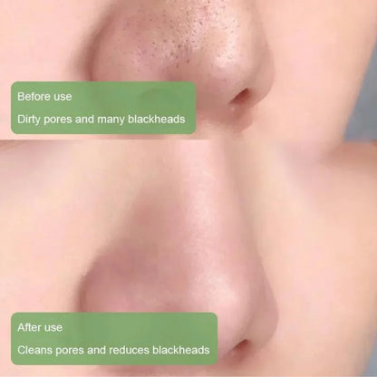 Green Tea Deep Cleanse Mask – Pore Detox & Glow