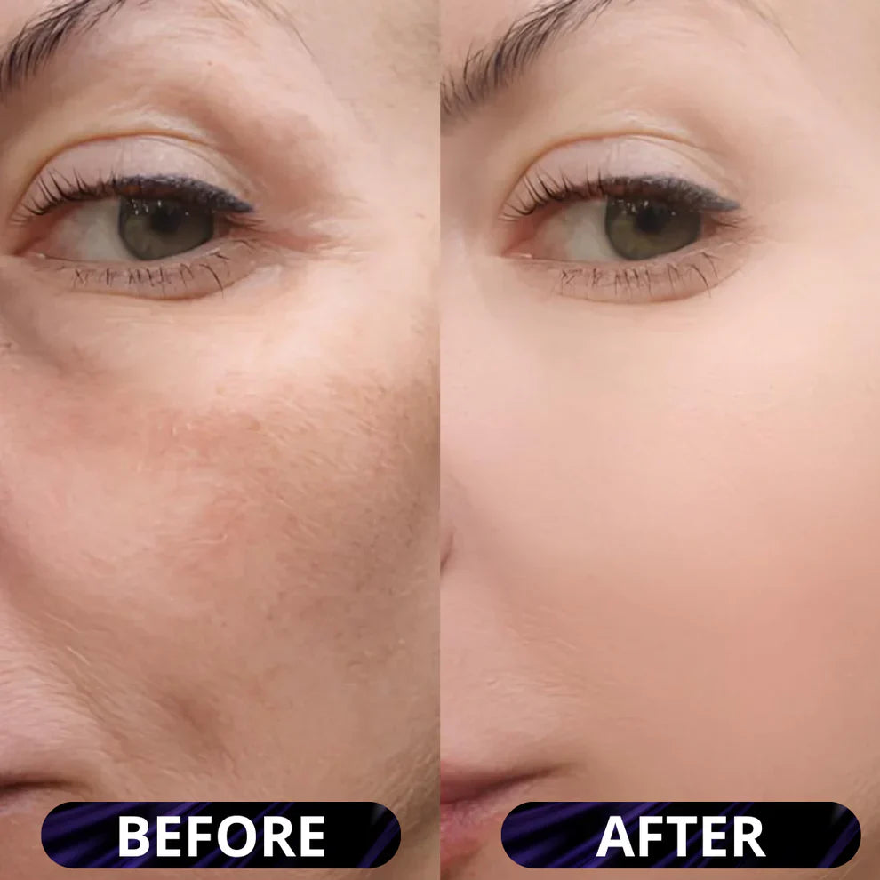 Green Tea Deep Cleanse Mask – Pore Detox & Glow
